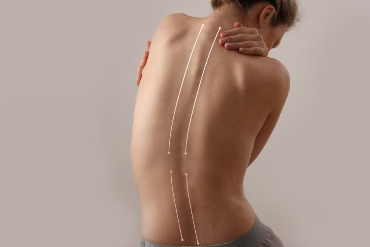 How Upper Cervical Chiropractic Can Improve Your Posture Key Insights