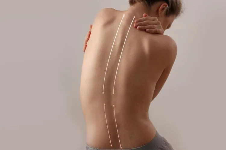 How Upper Cervical Chiropractic Can Improve Your Posture Key Insights