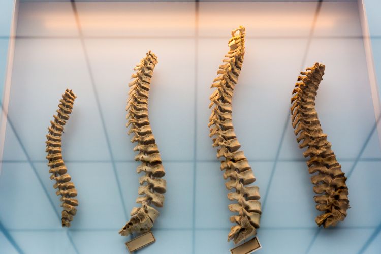 Section 1: Erecting the Pillar of Wellness: Understanding Spine Health
