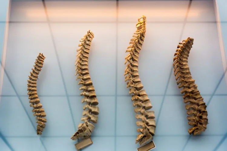 Section 1: Erecting the Pillar of Wellness: Understanding Spine Health