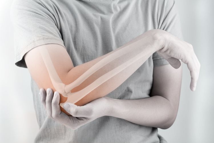 Decoding Tennis Elbow- More Than Just an Athlete’s Woe
