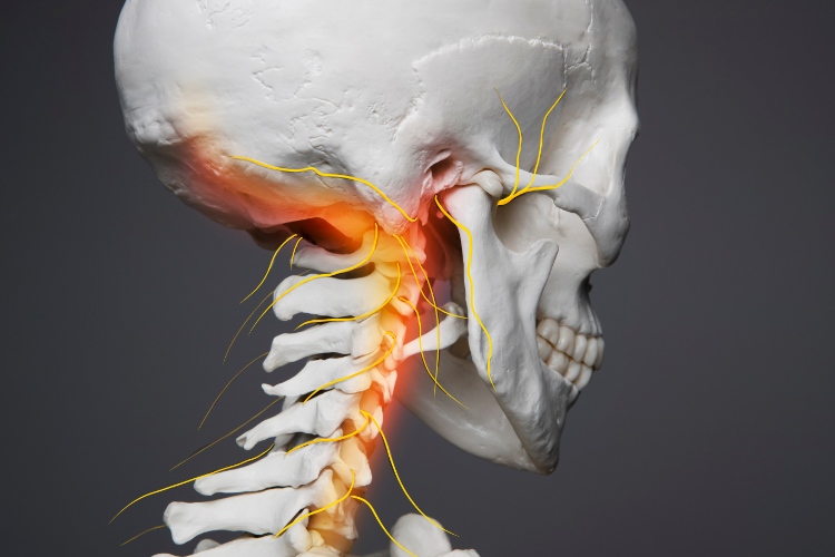 Vertebrobasilar Insufficiency: Can Upper Cervical Chiropractic Make a Difference?