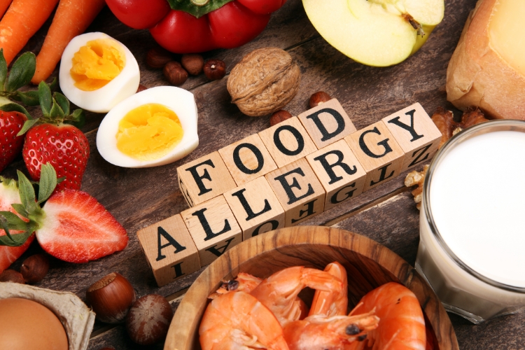 Holistic Approach to Allergy Management